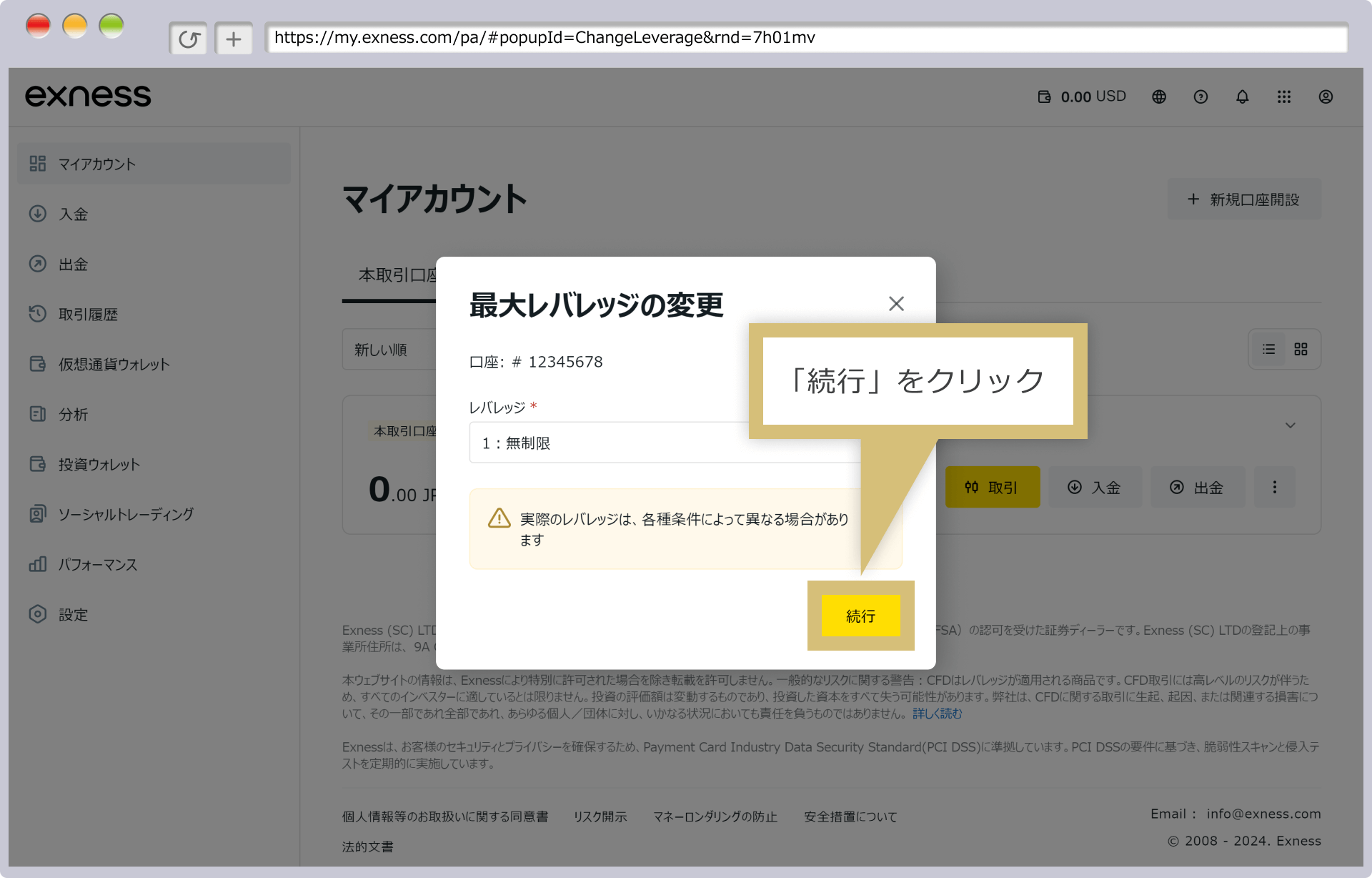 最大レバレッジを設定